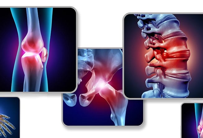Cause and Effects: Musculoskeletal Disorders (MSDs) in Manufacturing